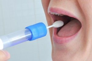 Tumore, un test della saliva per sapere in 10 minuti se si è affetti da questa malattia Tumore, un test della saliva per sapere in 10 minuti se si è affetti da questa malattia