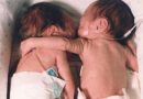 La foto di queste due gemelline abbracciate ha fatto il giro del web, eccole oggi dopo 22 anni La foto di queste due gemelline abbracciate ha fatto il giro del web, eccole oggi dopo 22 anni
