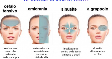 10 tipi diversi di mal di testa, ognuno ha un significato ben preciso, scoprilo 10 tipi diversi di mal di testa, ognuno ha un significato ben preciso, scoprilo