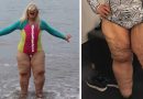 La prendevano in giro per le sue gambe da “elefante” lei li zittisce con un post in modo geniale La prendevano in giro per le sue gambe da “elefante” lei li zittisce con un post in modo geniale