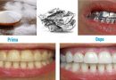 Ecco il rimedio casalingo che ti farà evitare la visita dal dentista – Bastano 3 semplici ingredienti per riavere i denti bianchissimi Ecco il rimedio casalingo che ti farà evitare la visita dal dentista – Bastano 3 semplici ingredienti per riavere i denti bianchissimi