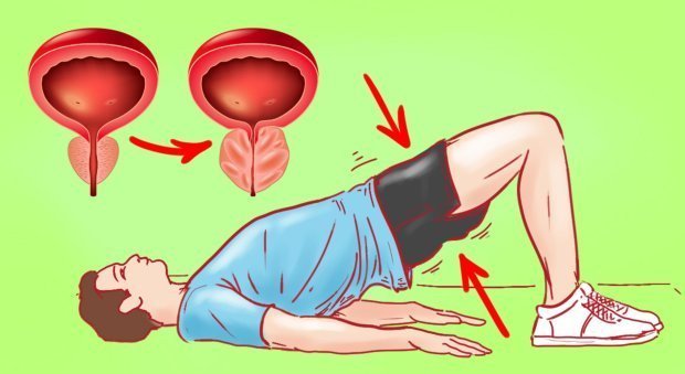 Gimnastica si sport cu prostatita si adenom de prostata
