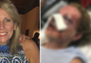 Una storia orribile, donna lasciata in fin di vita durante una vacanza nella Repubblica Dominicana Una storia orribile, donna lasciata in fin di vita durante una vacanza nella Repubblica Dominicana