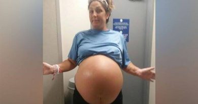 I medici durante il parto iniziarono a ridere – Una volta data la spiegazione la madre rimase sorpresa da ciò che stava accadendo I medici durante il parto iniziarono a ridere – Una volta data la spiegazione la madre rimase sorpresa da ciò che stava accadendo