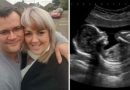 La madre nota che la bambina smette di muoversi dopo 30 settimane – I dottori scoprono il fatale problema e decidono di intervenire immediatamente La madre nota che la bambina smette di muoversi dopo 30 settimane – I dottori scoprono il fatale problema e decidono di intervenire immediatamente