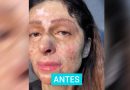 Per la prima volta nella sua vita si trucca dopo un incidente: piange appena vede il suo viso allo specchio Per la prima volta nella sua vita si trucca dopo un incidente: piange appena vede il suo viso allo specchio