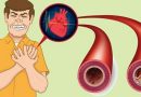 12 alimenti che contribuiscono a purificare le arterie proteggendoti dalle malattie cardiovascolari 12 alimenti che contribuiscono a purificare le arterie proteggendoti dalle malattie cardiovascolari
