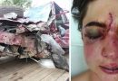 Diciassettenne usa il telefono mentre guida – La madre ha voluto condividere le orribili foto dell’incidente per avvertire genitori e figli Diciassettenne usa il telefono mentre guida – La madre ha voluto condividere le orribili foto dell’incidente per avvertire genitori e figli