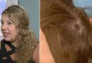Doveva essere una semplice visita dal parrucchiere, ma una terrificante scoperta tra i capelli le ha salvato la vita Doveva essere una semplice visita dal parrucchiere, ma una terrificante scoperta tra i capelli le ha salvato la vita