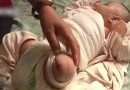 Il neonato deve amputarsi la gamba dopo che l’infermiera l’ha ustionato con l’asciuga capelli Il neonato deve amputarsi la gamba dopo che l’infermiera l’ha ustionato con l’asciuga capelli